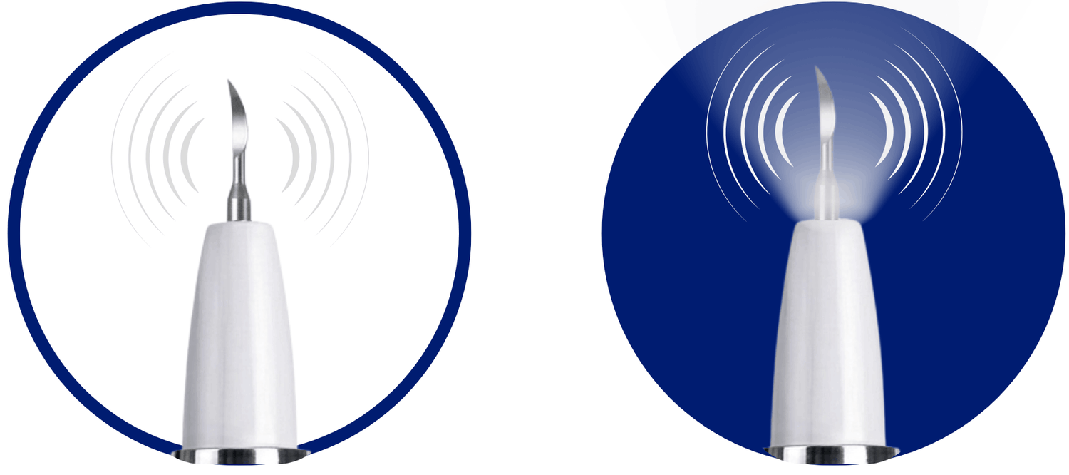 Ultrasonic cleaning tip and built-in LED light