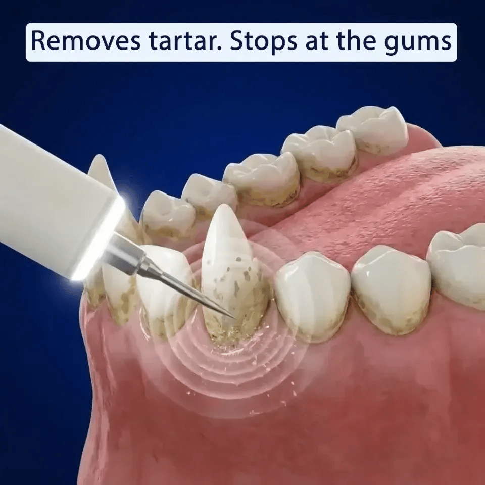 Silent Ultrasonic Plaque & Tartar Remover for dogs